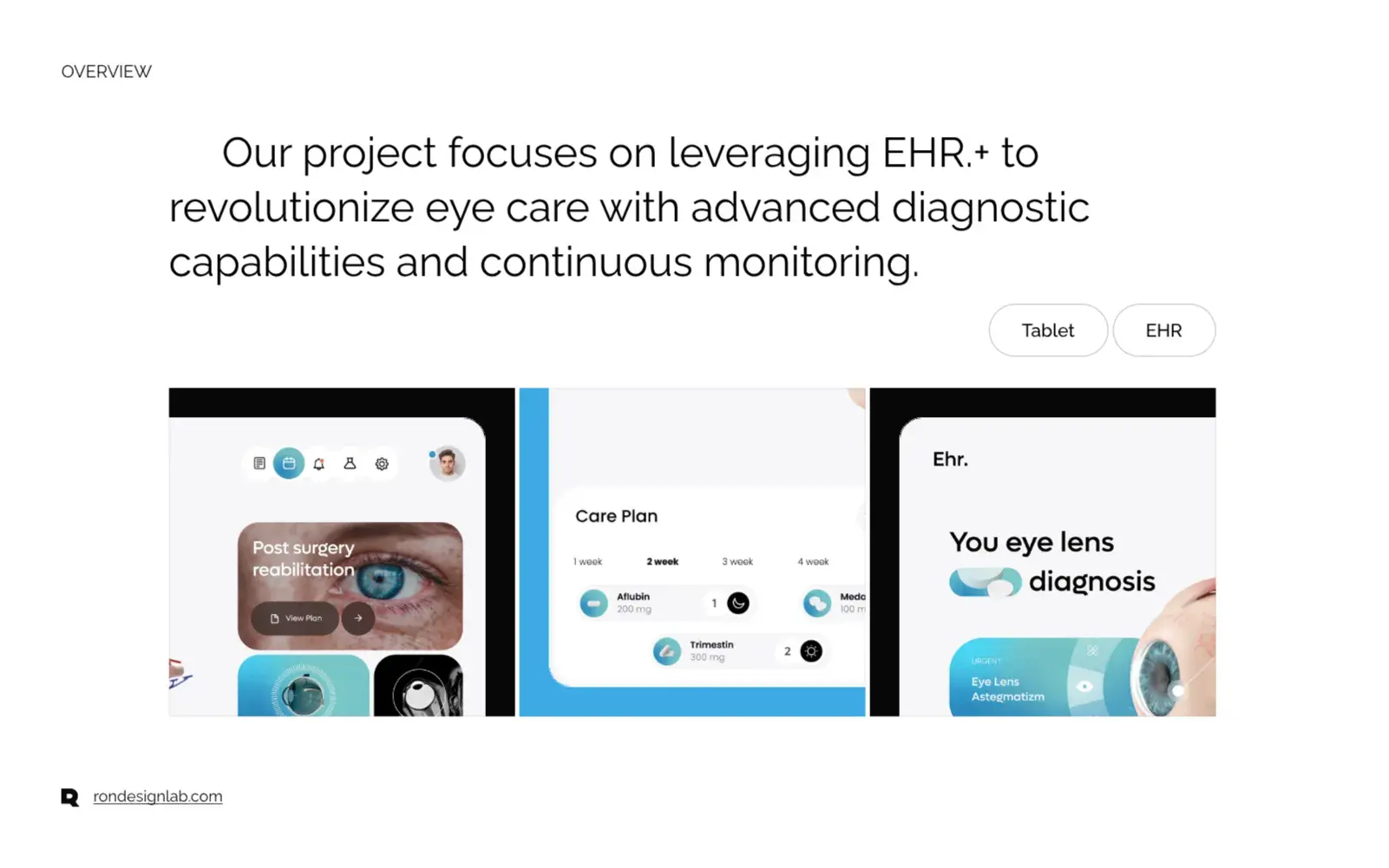 Screenshot of an EHR tablet interface displaying advanced eye diagnosis and monitoring data.