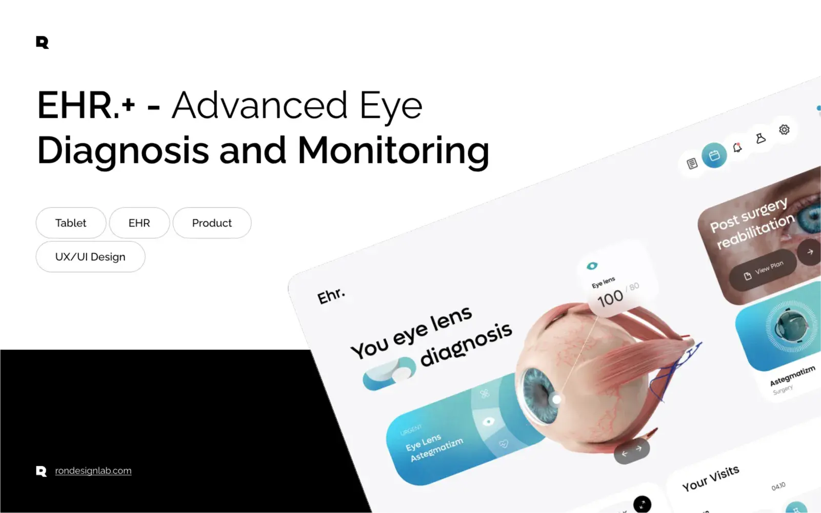 Screenshot of an ophthalmology EHR interface on a tablet, showing advanced eye diagnosis and monitoring features.