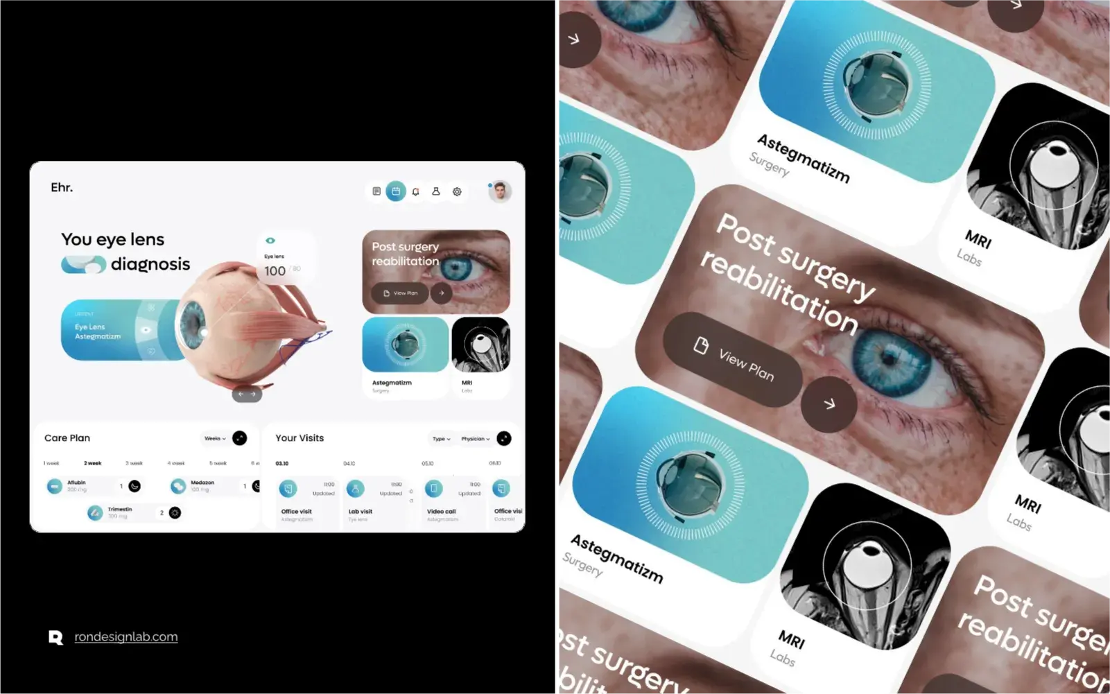 Screenshot of an advanced EHR tablet interface for eye diagnosis and monitoring.