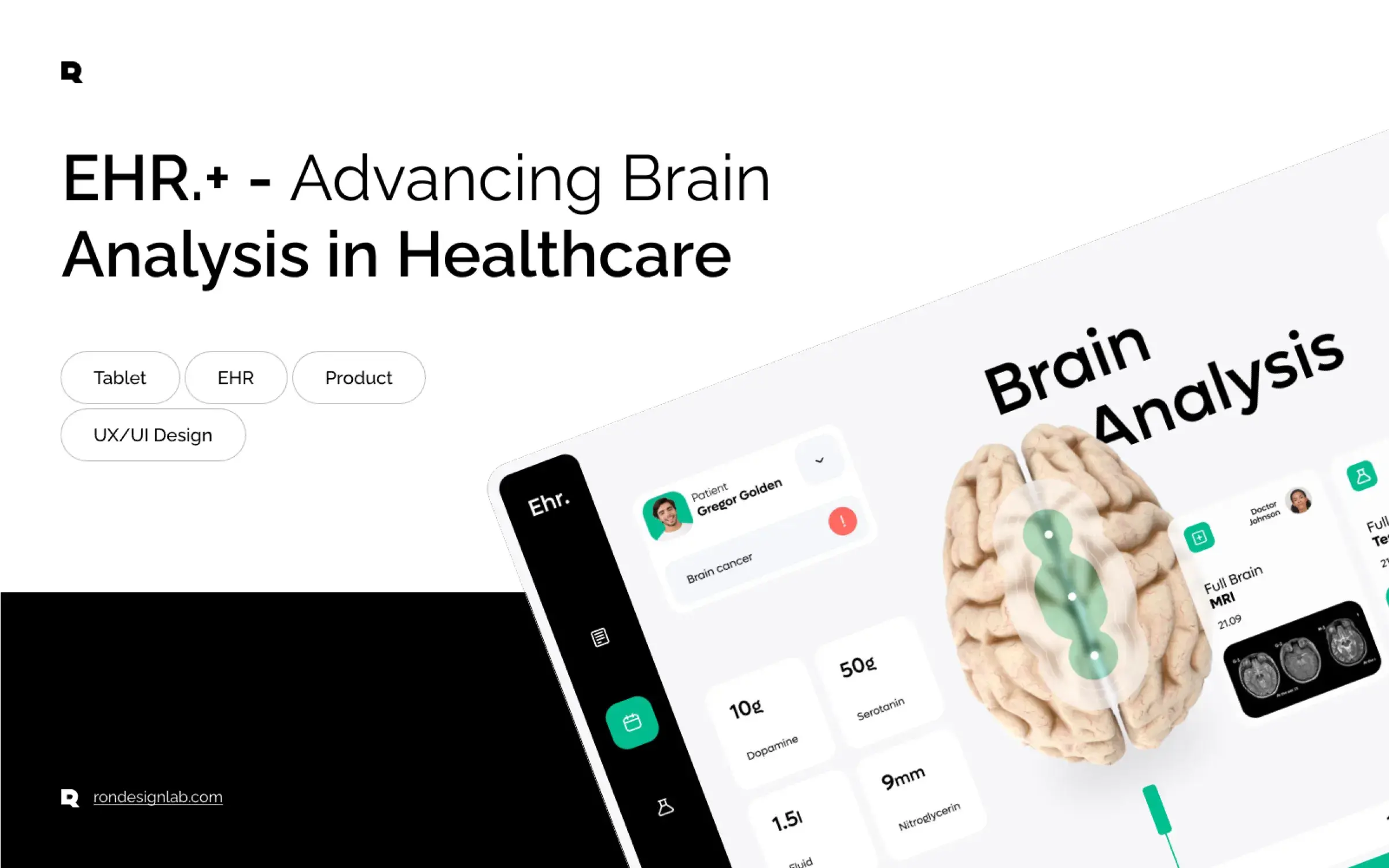 Screenshot of a diagram visualizing advanced brain analysis data within an EHR interface, displayed on a tablet.