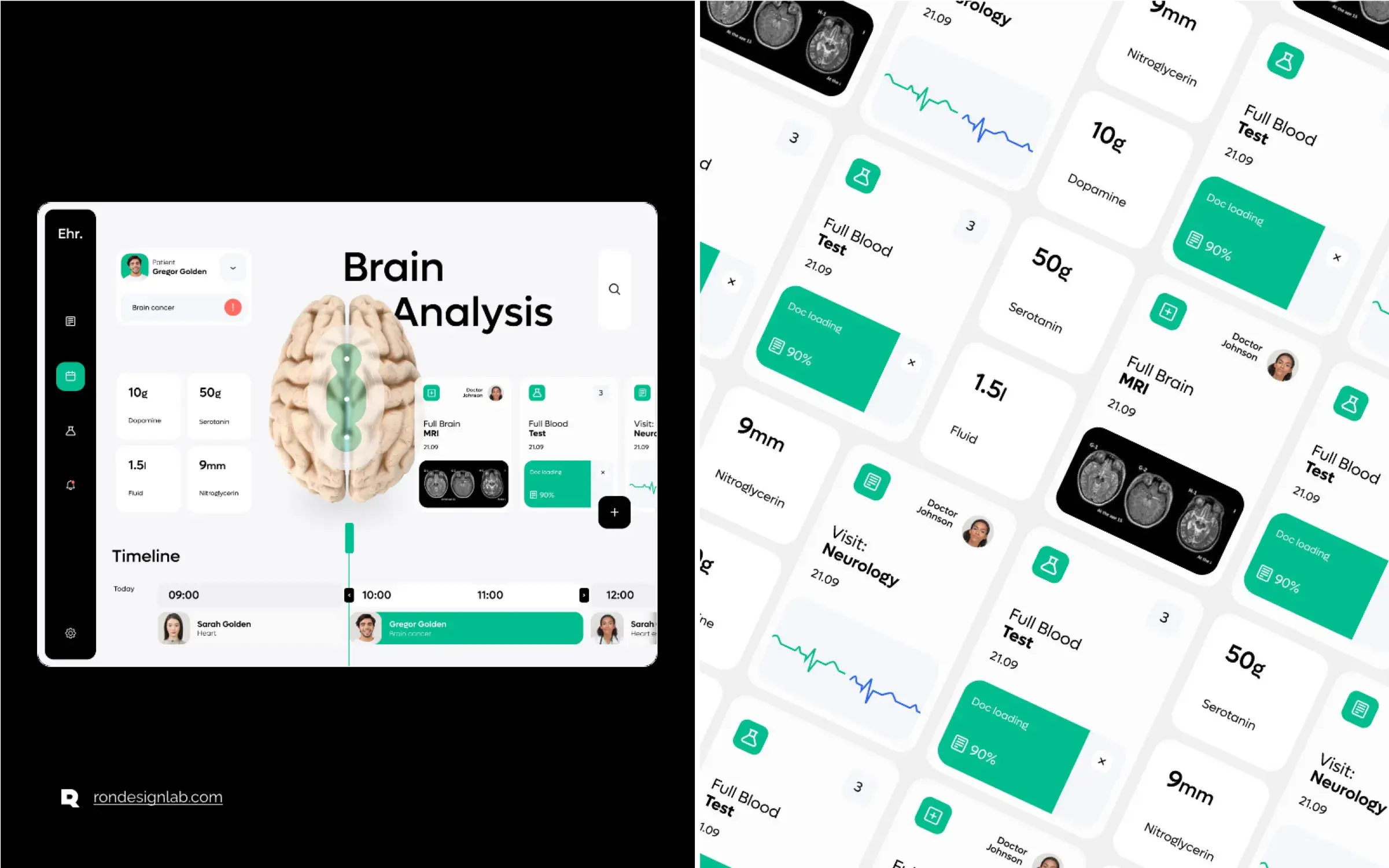 Screenshot of EHR interface showing advanced brain analysis data on a tablet.