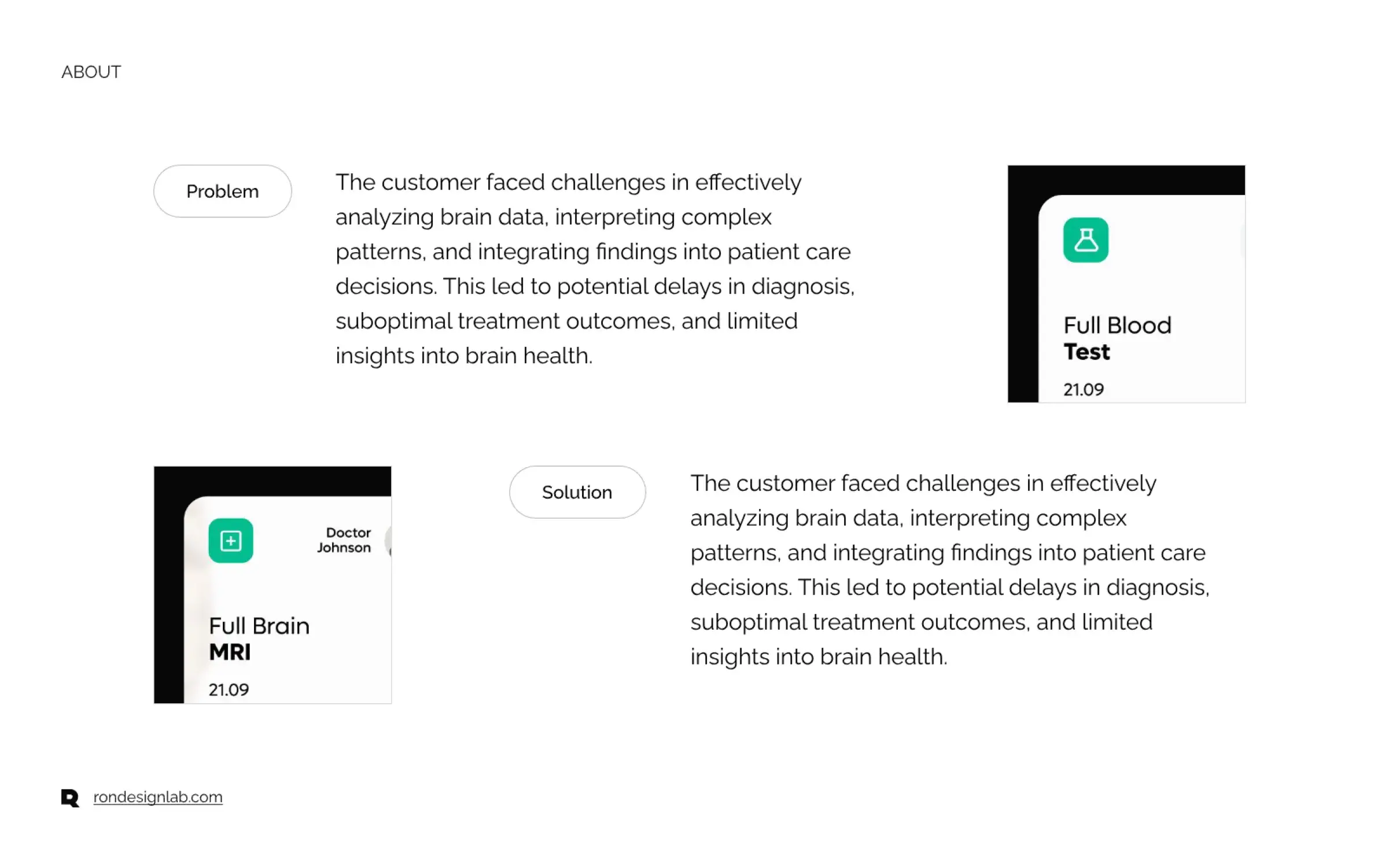 Tablet screenshot showing an EHR interface advancing brain analysis data in a healthcare setting.