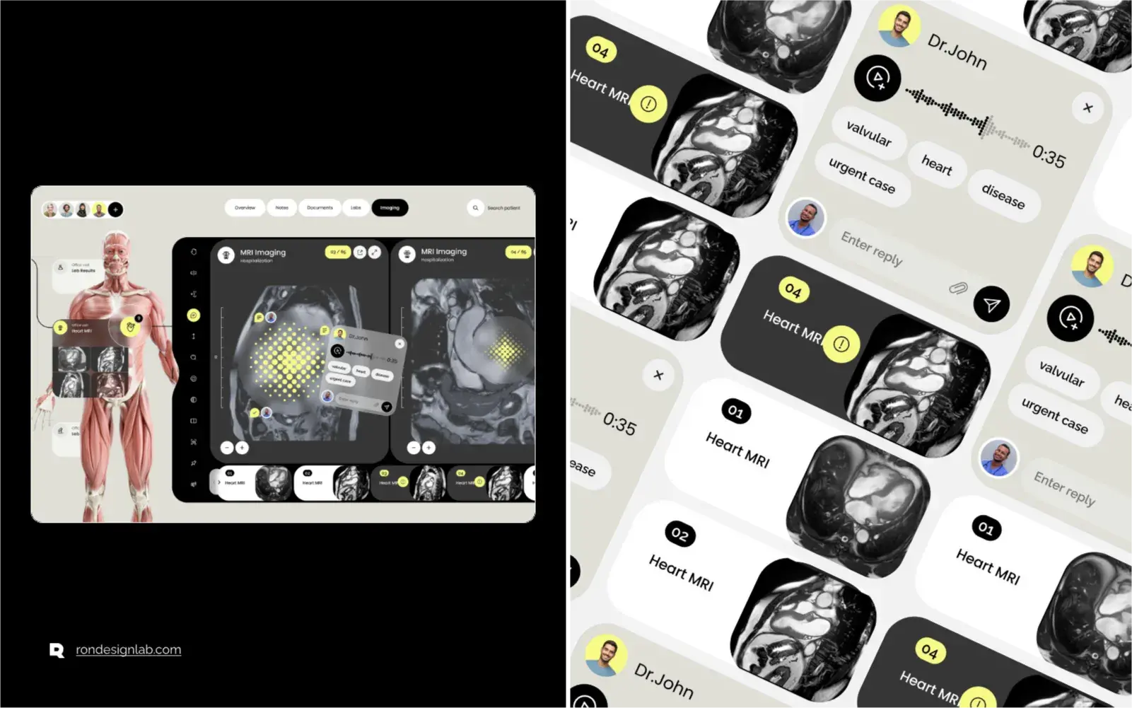 Person using an iPhone to view streamlined medical imaging records via EMR+.