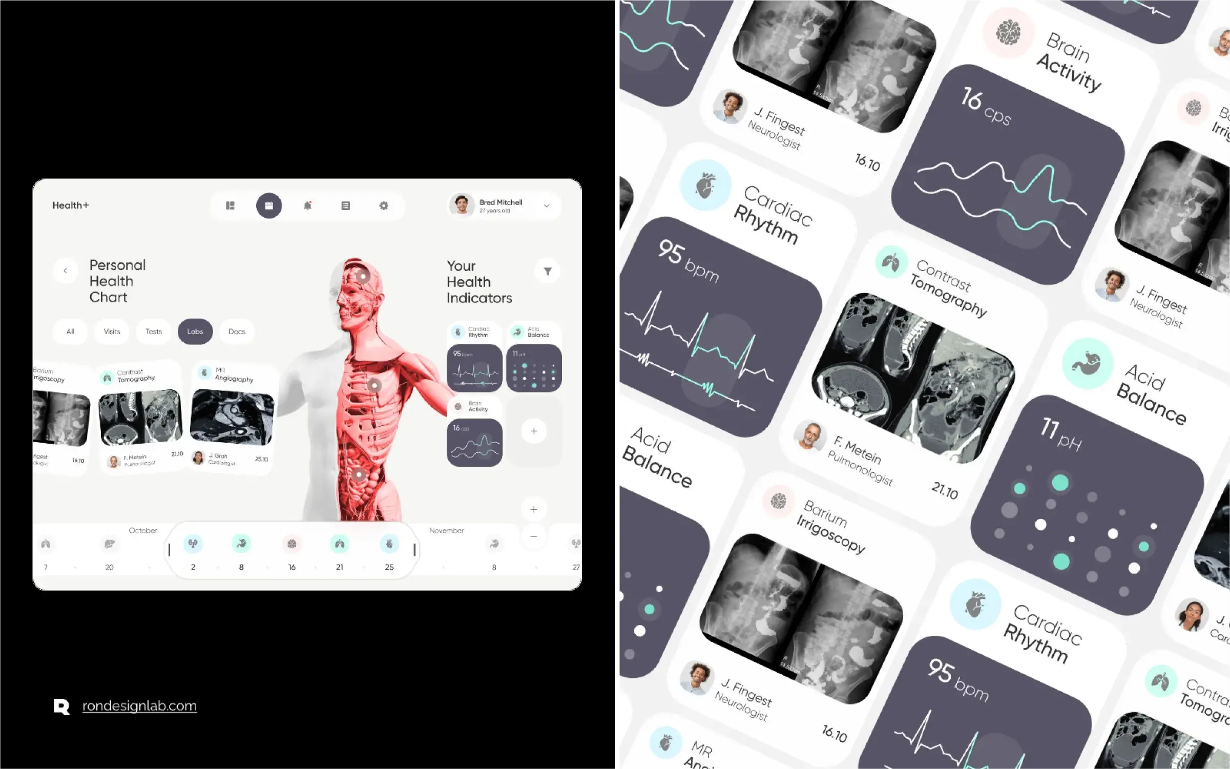 Screenshot showing Your Personalized Health Chart within the Health+ EHR application on a mobile device.