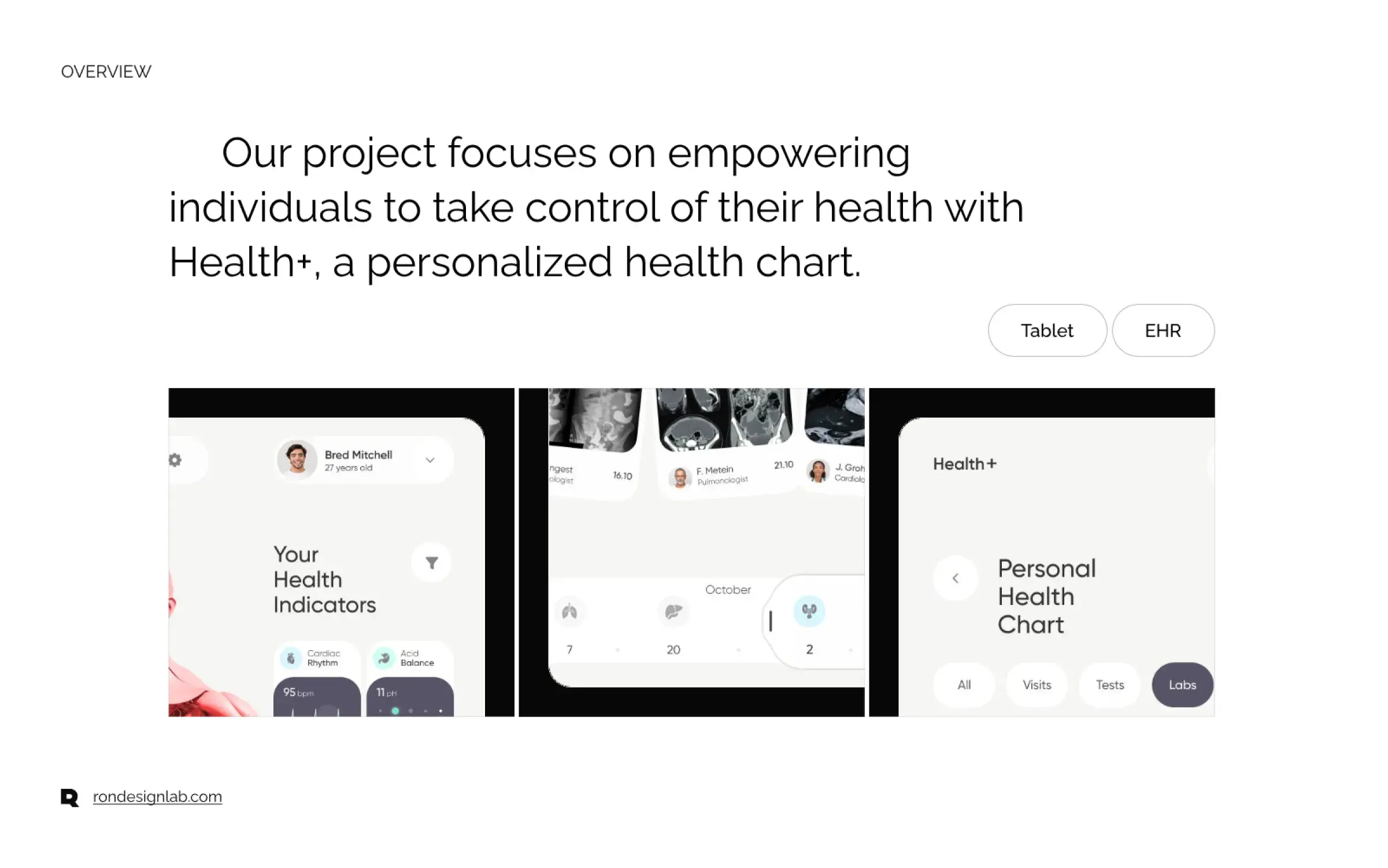 Screenshot of the Health+ personalized health chart dashboard within an EHR interface on a tablet.