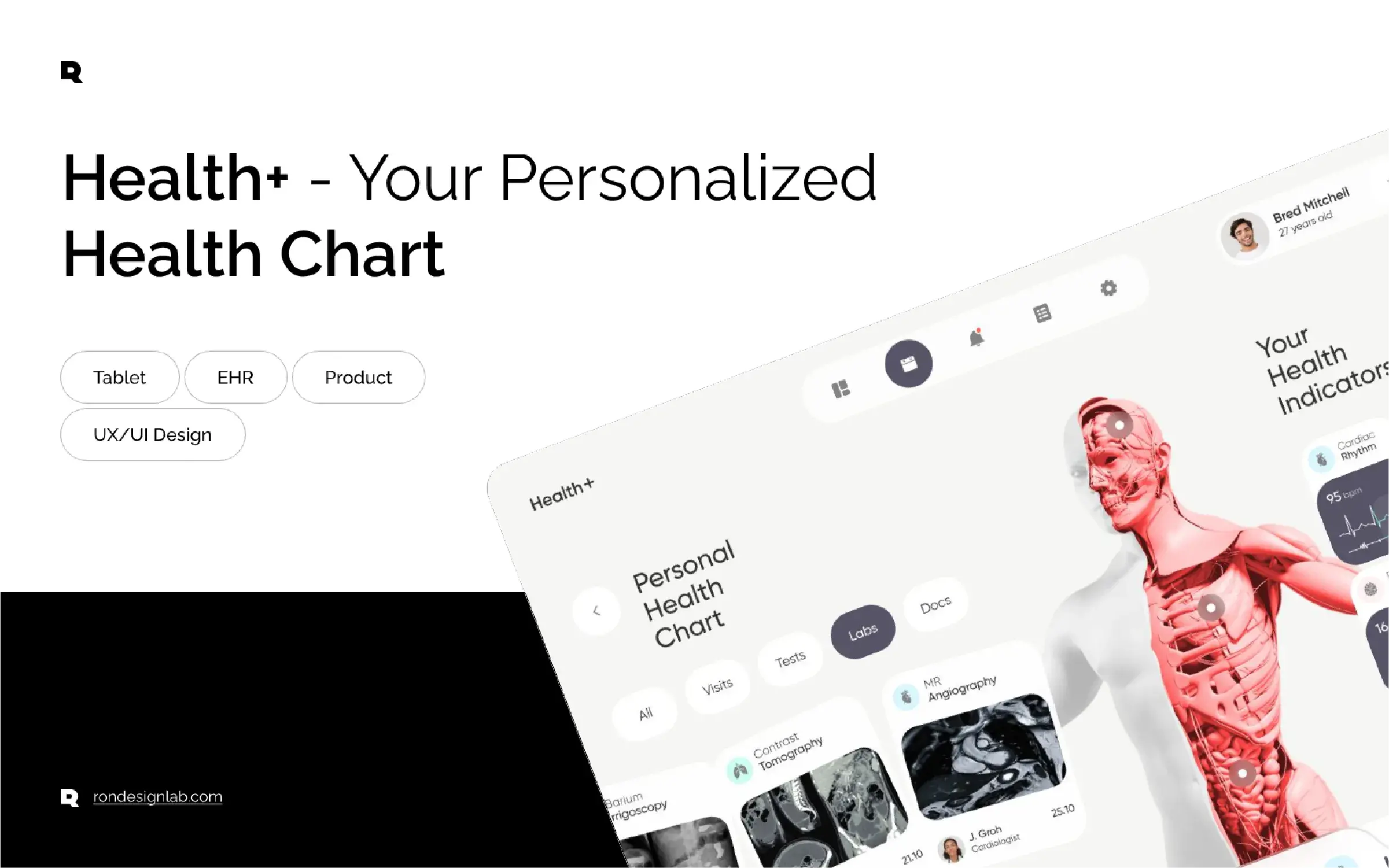 Screenshot of a tablet displaying the personalized Health+ health chart.